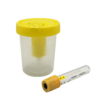 Urine Collection and Preservation