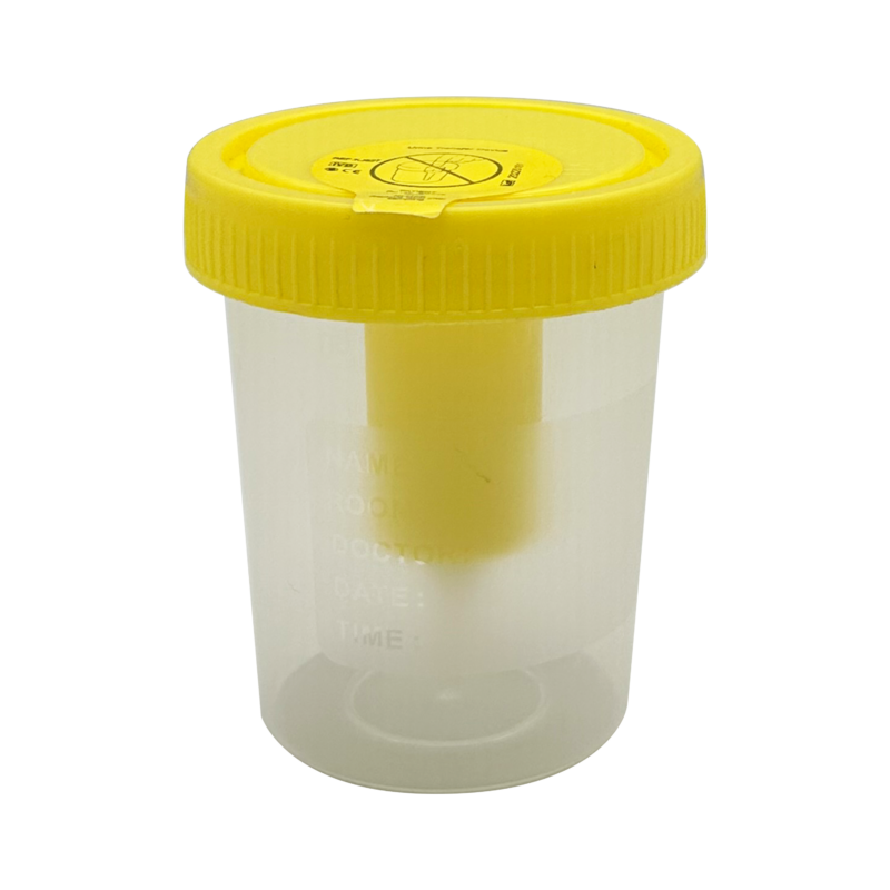 Urine Collection and Preservation
